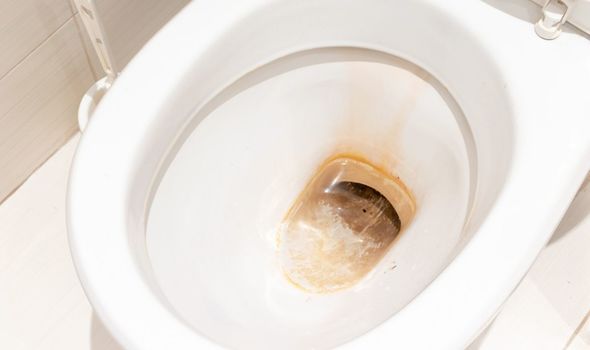 How to Remove Yellow Urine Stains from Toilet Bowl